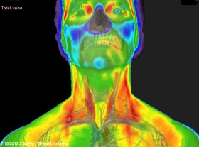 medical thermography Thyroid1
